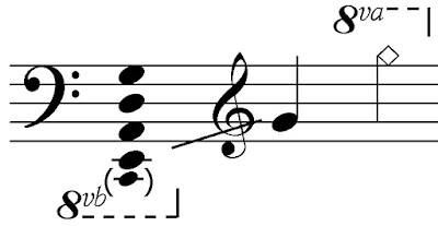 Bass guitar