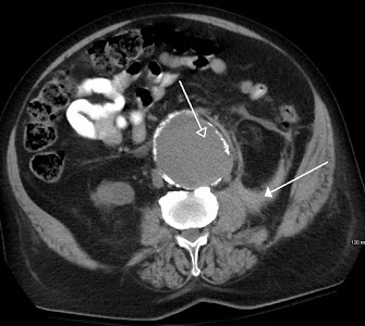 Medical imaging