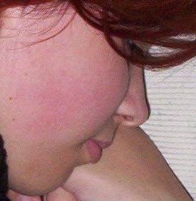 Cheek